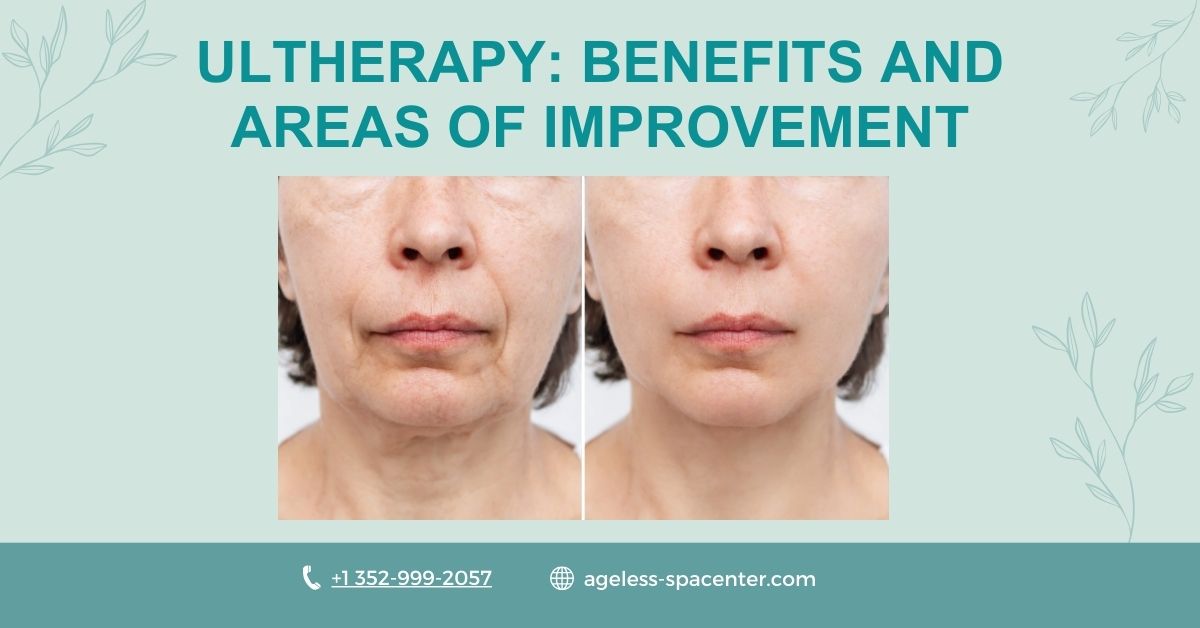 Ultherapy Benefits and Areas of Improvement